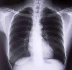 x ray scanning